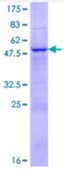 SDS-PAGE (KLK6-4932H).jpg